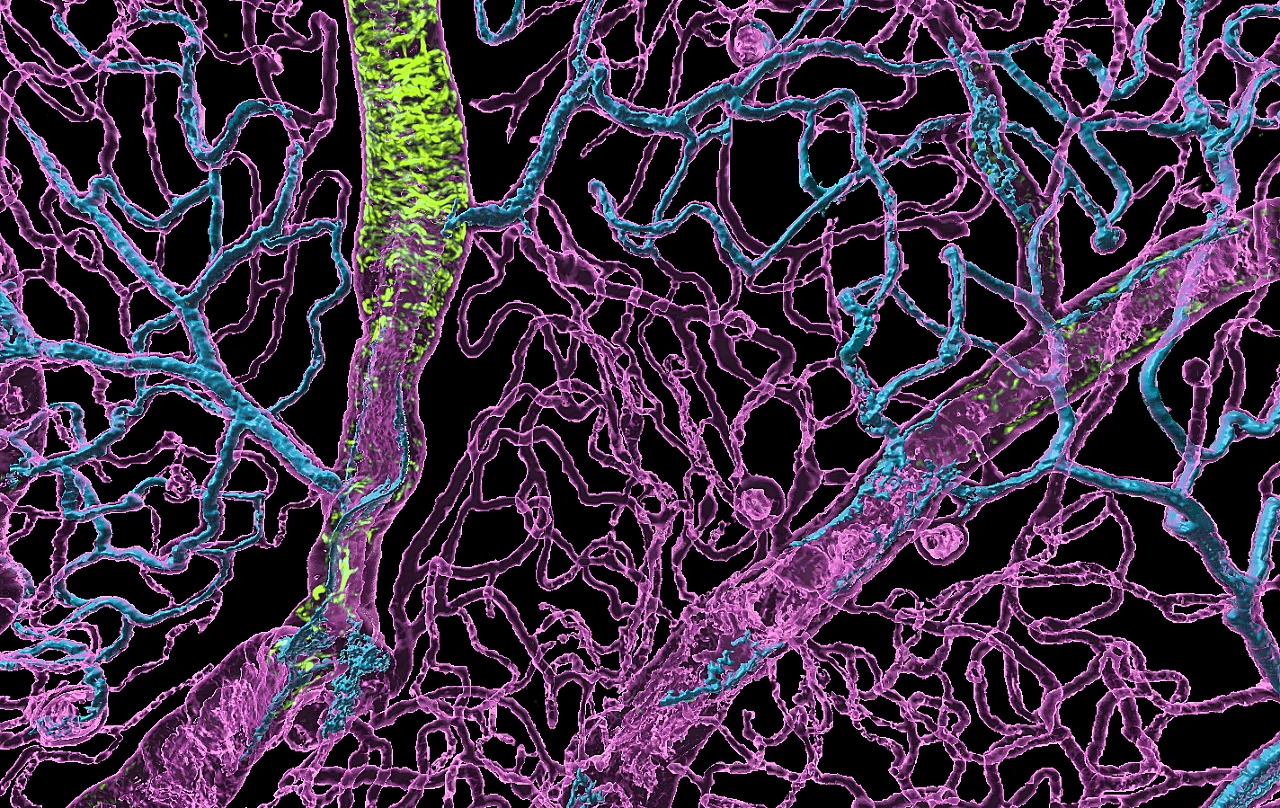 NIHR Biomedical Research Centre: Moorfields